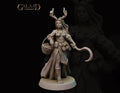 Female Druid Miniature | Tabletop RPG Miniature | Galaad Miniatures | Roleplaying 3D Printed Fantasy Mini - 3DPrintDen